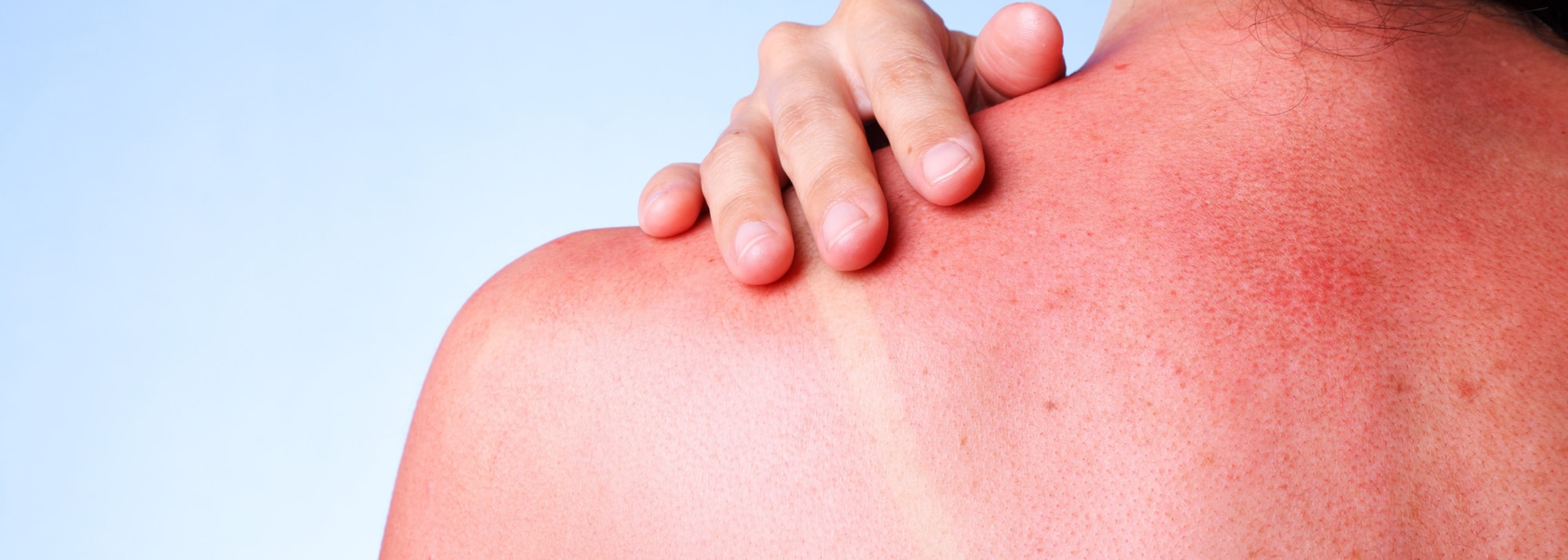 The Dark Side of Traditional Tanning: A Leading Cause of Skin Cancer